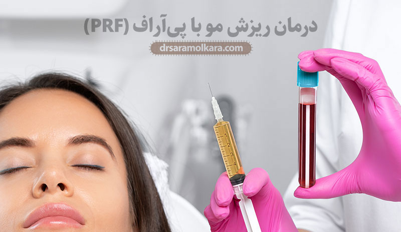 درمان-ریزش-مو-با-پی‌آر‌اف
