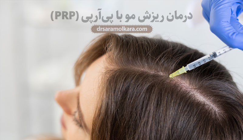 درمان ریزش مو با پی‌آر‌پی (PRP)