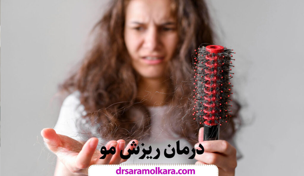درمان ریزش مو در مشهد