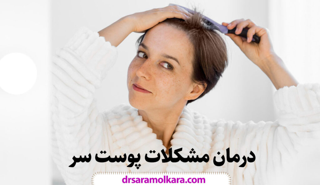 درمان مشکلات پوست سر