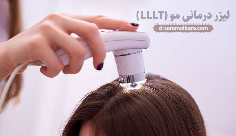 لیزر-درمانی-مو-(LLLT)