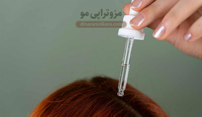 مزوتراپی مو با کوکتل‌های تقویتی اختصاصی
