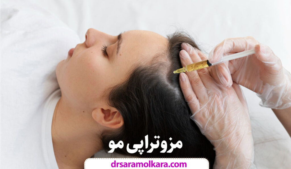 مزوتراپی مو در مشهد