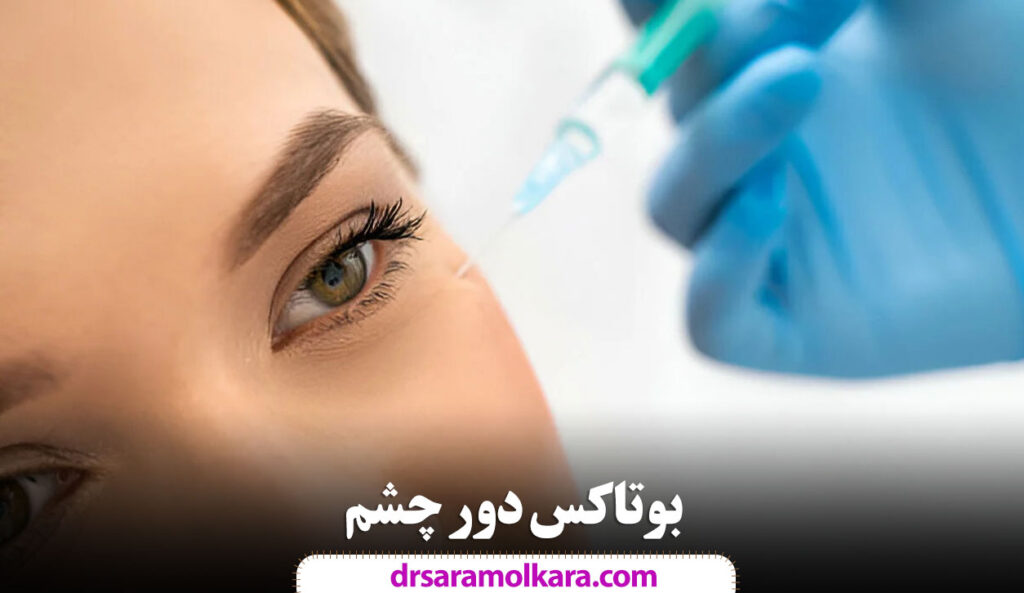 بوتاکس دور چشم؛ این روش تنها در ۱۵ دقیقه معجزه می‌کند!