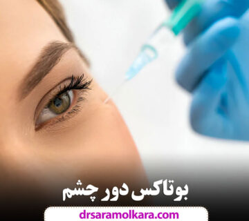 بوتاکس دور چشم؛ این روش تنها در ۱۵ دقیقه معجزه می‌کند!