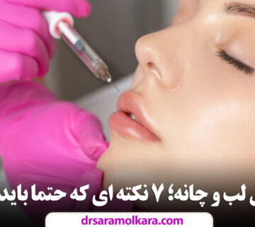 بوتاکس لب و چانه؛ ۷ نکته ای که حتما باید بدانید