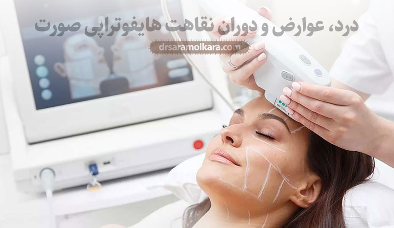 درد، عوارض و دوران نقاهت هایفوتراپی صورت 