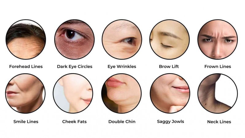 انواع هایفوتراپی بر اساس ناحیه درمان