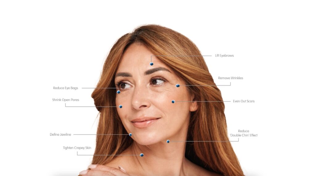 جدول مقایسه انواع هایفوتراپی