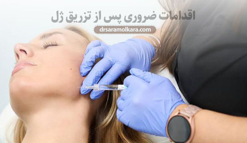 اقدامات ضروری در ۴۸ ساعت طلایی پس از تزریق ژل