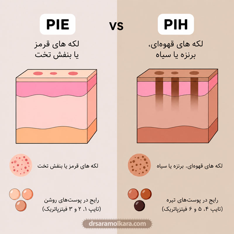 تفاوت لک‌های قرمز و قهوه‌ای با فرورفتگی‌ها
