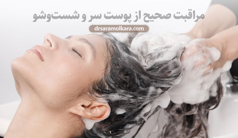 مراقبت صحیح از پوست سر و شست‌وشو