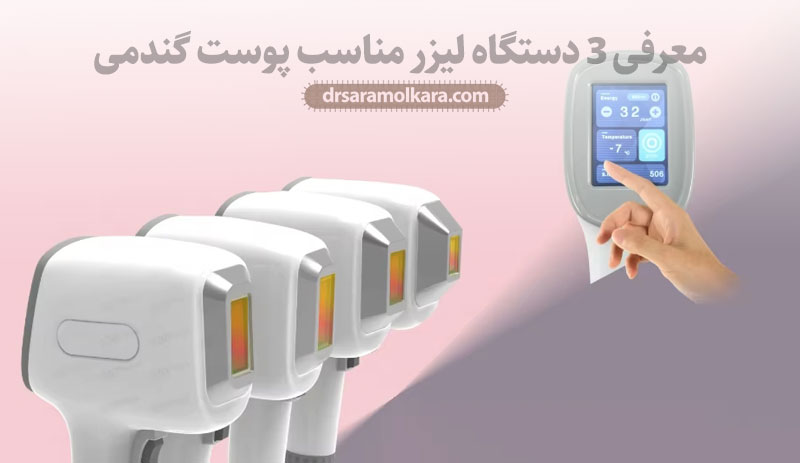 معرفی ۳ دستگاه لیزر مناسب پوست گندمی