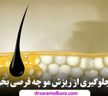 برای جلوگیری از ریزش مو چه قرصی بخوریم؟