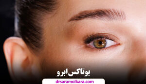 بوتاکس ابرو
