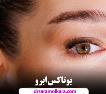 بوتاکس ابرو