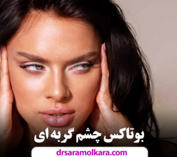 بوتاکس چشم گربه‌ ای