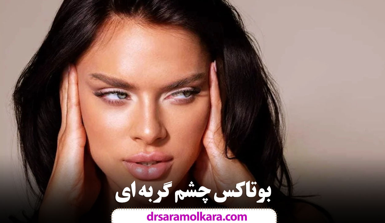 بوتاکس چشم گربه‌ ای
