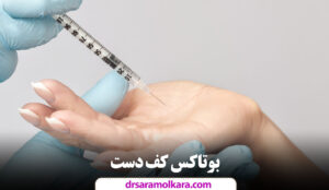 بوتاکس کف دست در مشهد