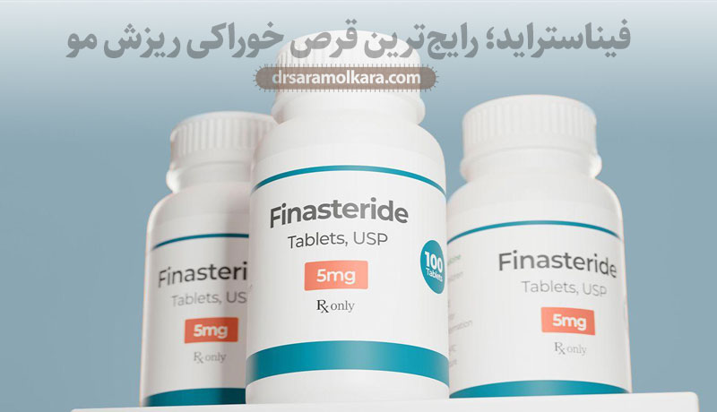 فیناستراید؛ رایج‌ترین قرص خوراکی ریزش مو