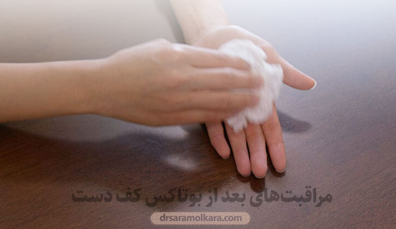 مراقبت‌های بعد از بوتاکس کف دست