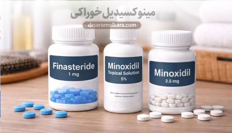 مینوکسیدیل خوراکی؛ گزینه‌ی نسبتاً جدید