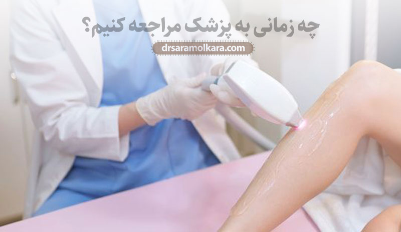 چه زمانی برای از بین بردن لکه های قهوه ای جای جوش روی پا به پزشک مراجعه کنیم؟