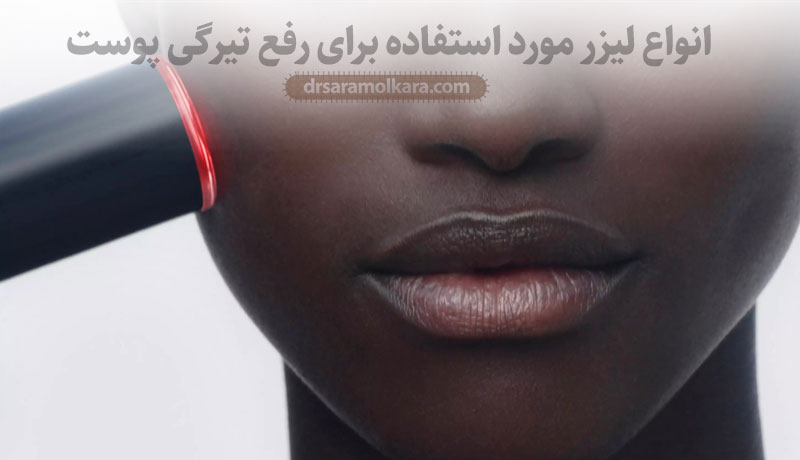 انواع لیزر مورد استفاده برای رفع تیرگی پوست