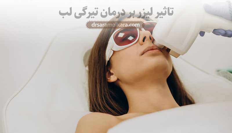 تاثیر لیزر بر درمان تیرگی لب