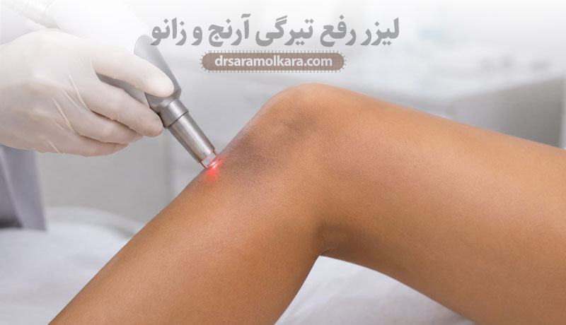 لیزر رفع تیرگی آرنج و زانو
