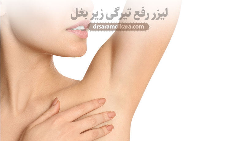 لیزر رفع تیرگی زیر بغل