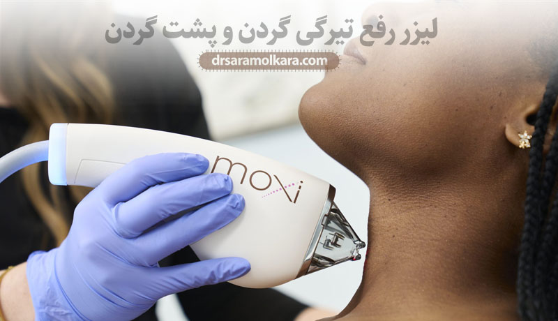 لیزر رفع تیرگی گردن و پشت گردن