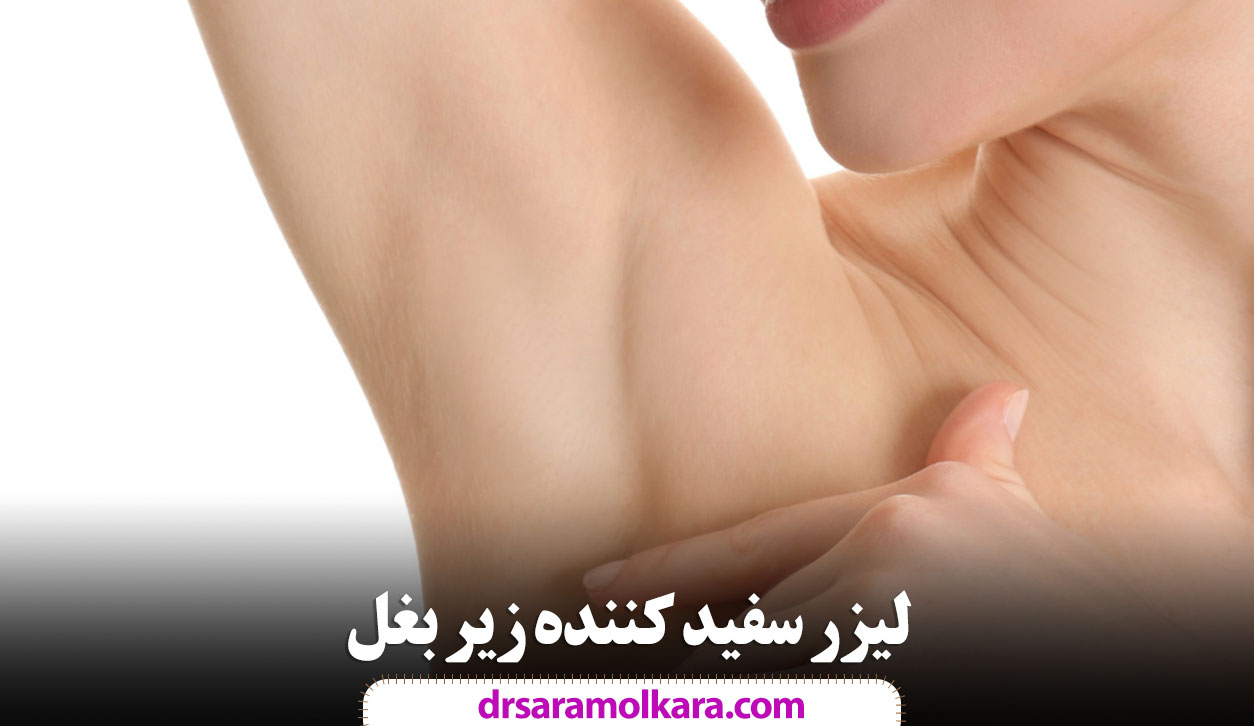 لیزر سفید کننده زیر بغل مشهد