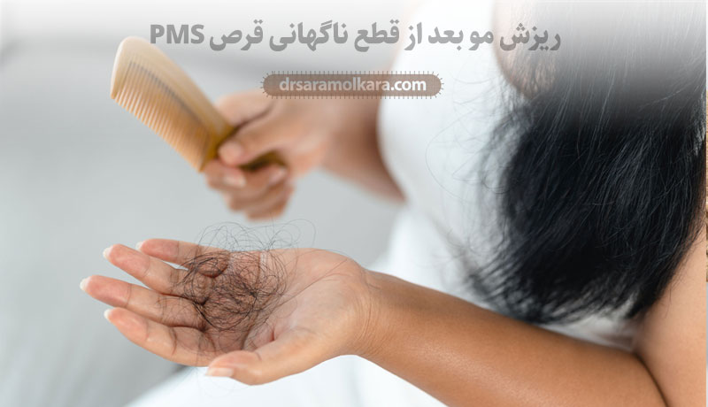 ریزش مو بعد از قطع ناگهانی قرص PMS 
